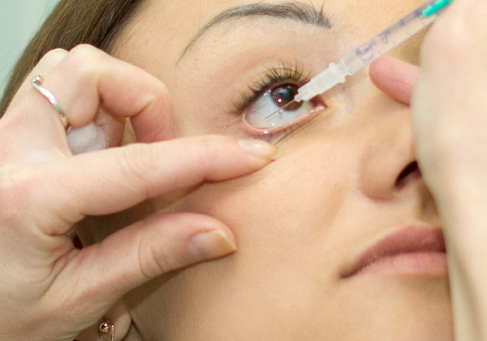 A injeção intravítrea é um tratamento que tem ganhado cada vez mais popularidade na oftalmologia.