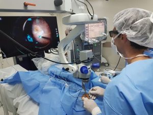 As cirurgias de retina são procedimentos realizados por oftalmologistas especializados para tratar problemas oculares que afetam a retina, a camada sensível à luz que reveste a parte de trás do olho e é responsável por enviar informações visuais ao cérebro.