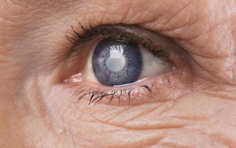 O glaucoma afeta 2% dos brasileiros acima de 40 anos: cerca de 1 milhão de pessoas, segundo a Sociedade Brasileira do Glaucoma. E assim como a catarata, também é uma doença que atinge principalmente pessoas mais velhas – o risco chega a triplicar após os 70 anos de idade.