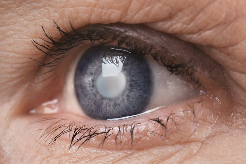 principais doenças oculares