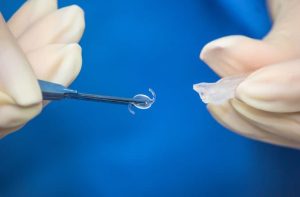 Diferença entre lente intraocular simples e lente intraocular premium