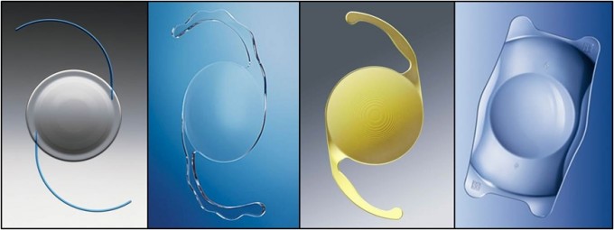 Diferença entre lente intraocular simples e lente intraocular premium