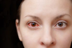 A importância da prevenção de doenças oculares