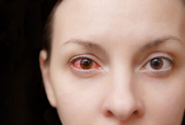 A importância da prevenção de doenças oculares